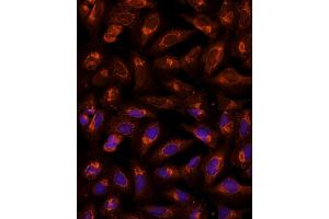 Immunofluorescence analysis of U-2 OS cells using BFAR Polyclonal Antibody (ABIN6127492, ABIN6137542, ABIN6137543 and ABIN6224322) at dilution of 1:100 (40x lens). (BFAR antibody  (AA 1-140))