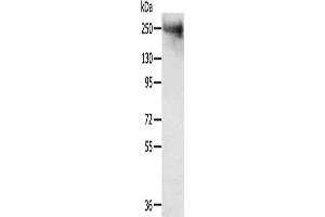 Gel: 6 % SDS-PAGE, Lysate: 40 μg, Lane: Mouse muscle tissue, Primary antibody: ABIN7192726(TACC2 Antibody) at dilution 1/300, Secondary antibody: Goat anti rabbit IgG at 1/8000 dilution, Exposure time: 5 minutes (TACC2 antibody)