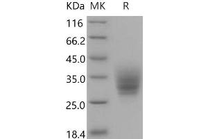 Western Blotting (WB) image for Basigin (Ok Blood Group) (BSG) (AA 1-209) protein (His tag) (ABIN7320310) (CD147 Protein (AA 1-209) (His tag))