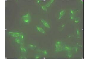 Immunofluorescence staining of human LNCap cell colony with monoclonal anti- human STEAP1 antibody (J2D2) (STEAP1 antibody  (AA 1-70))