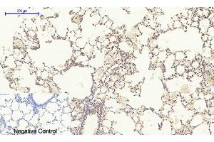 Immunohistochemical analysis of paraffin-embedded rat lung tissue. (MEK1/2 antibody)