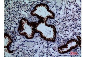 Immunohistochemistry (IHC) analysis of paraffin-embedded Mouse Lung, antibody was diluted at 1:100. (DPYD antibody  (Internal Region))