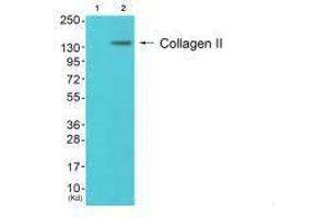 Western blot analysis of extracts from 3T3 cells (Lane 2), using Collagen II antiobdy. (COL2A1 antibody)