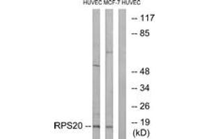 Western blot analysis of extracts from HuvEc/MCF-7 cells, using RPS20 Antibody. (RPS20 antibody  (AA 31-80))
