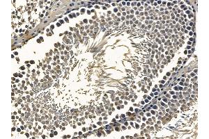 ABIN6259575 and ABIN6275740 at 1/100 staining rat testis tissue by IHC-P.