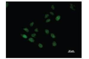 Immunostaining analysis in HeLa cells. (BTAF1 antibody)