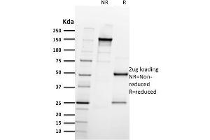 SDS-PAGE Analysis Purified CD61 Mouse Monoclonal Antibody (ITGB3/2597). (Integrin beta 3 antibody  (AA 385-490))