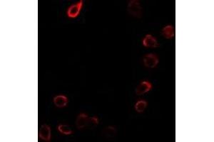 Immunofluorescent analysis of CDKN3 staining in MCF7 cells. (CDKN3 antibody)