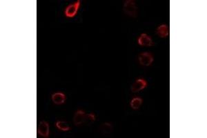 Immunofluorescent analysis of CDKN3 staining in MCF7 cells.