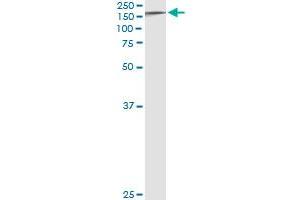 Immunoprecipitation of TYK2 transfected lysate using anti-TYK2 monoclonal antibody and Protein A Magnetic Bead , and immunoblotted with TYK2 MaxPab rabbit polyclonal antibody. (TYK2 antibody  (AA 276-375))