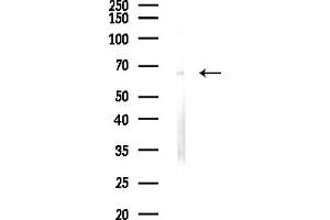 Western blot analysis of lysates from Hela cells(starvation,24h treatment), using Collagen X Antibody at 1/1000 dilution.