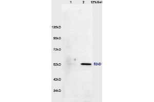 Lane 1: mouse lung lysates Lane 2: mouse brain lysates probed with Anti phospho-MAPKAPK5(Thr182) Polyclonal Antibody, Unconjugated (ABIN710546) at 1:200 in 4 °C. (MAPKAP Kinase 5 antibody  (pThr182))