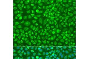 Immunofluorescence analysis of U2OS cells using DNAL1 Polyclonal Antibody at dilution of 1:100. (DNAL1 antibody)