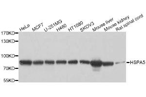 Western blot analysis of extracts of various cell lines, using HSPA5 antibody. (GRP78 antibody  (AA 550-650))