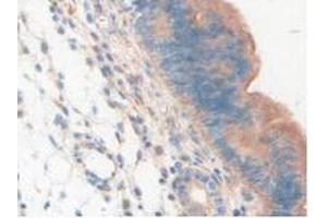 Figure. (LAMP2 antibody  (AA 295-410))