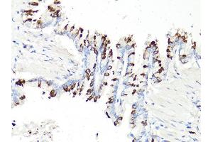 Immunohistochemistry of paraffin-embedded rat bronchial epithelium using PDCD1 antibody (ABIN6290170) at dilution of 1:100 (40x lens). (PD-1 antibody)