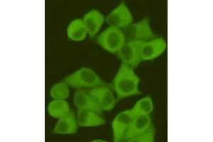 Immunocytochemistry staining of Hela cells fixed with 4 % Paraformaldehyde and using anti-Fatty Acid Synthase mouse mAb (dilution 1:400). (Fatty Acid Synthase antibody)