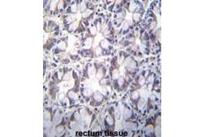TBCA Antibody (Center) immunohistochemistry analysis in formalin fixed and paraffin embedded human rectum tissue followed by peroxidase conjugation of the secondary antibody and DAB staining. (TBCA antibody  (Middle Region))