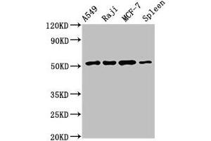 Western Blot Positive WB detected in: A549 whole cell lysate, Raji whole cell lysate, MCF-7 whole cell lysate, Rat spleen tissue All lanes: SERPINC1 antibody at 2. (SERPINC1 antibody  (AA 37-180))