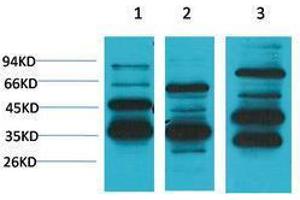 Western Blotting (WB) image for anti-MAS1 Oncogene (MAS1) antibody (ABIN3181533) (MAS1 antibody)