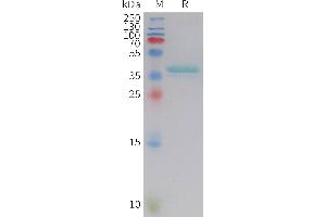 SDS-PAGE (SDS) image for Leptin (LEP) (AA 22-167) protein (Fc Tag) (ABIN7538352)
