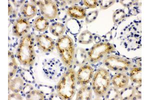 Immunohistochemistry (Paraffin-embedded Sections) (IHC (p)) image for anti-Keratin 19 (KRT19) (AA 334-372), (C-Term) antibody (ABIN3043288) (Cytokeratin 19 antibody  (C-Term))