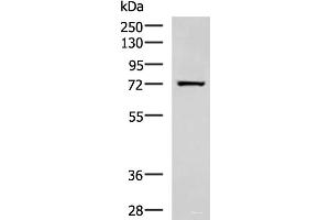 Western blot analysis of Human fetal liver tissue lysate using SHTN1 Polyclonal Antibody at dilution of 1:600