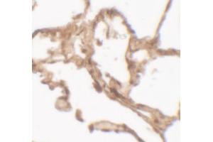 Immunohistochemistry (IHC) image for anti-Arylsulfatase B (ARSB) (C-Term) antibody (ABIN2457880)