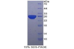 SDS-PAGE analysis of Human PSG1 Protein.