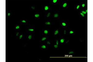 Immunofluorescence of purified MaxPab antibody to CENPH on HeLa cell.