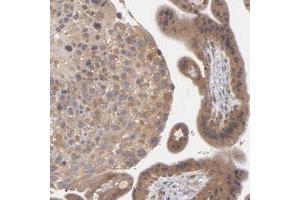 Immunohistochemical staining of human placenta with UPF3B polyclonal antibody  shows moderate cytoplasmic positivity in trophoblastic and decidual cells at 1:10-1:20 dilution. (UPF3B antibody)