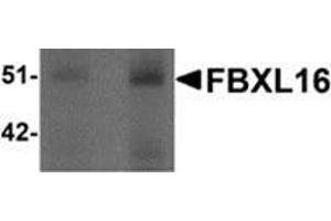 Western blot analysis of FBXL16 in human spleen tissue lysate with FBXL16 antibody at (left) 0. (FBXL16 antibody  (C-Term))