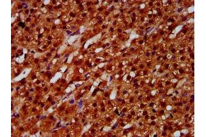 IHC image of ABIN7152082 diluted at 1:600 and staining in paraffin-embedded human adrenal gland tissue performed on a Leica BondTM system. (ETV5 antibody  (AA 124-265))