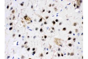 ZWINT was detected in paraffin-embedded sections of mouse brain tissues using rabbit anti- ZWINT Antigen Affinity purified polyclonal antibody (Catalog # ) at 1 µg/mL. (ZWINT antibody  (AA 29-249))