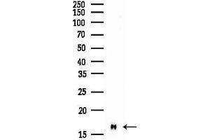 anti-Profilin 1 (PFN1) (C-Term) antibody