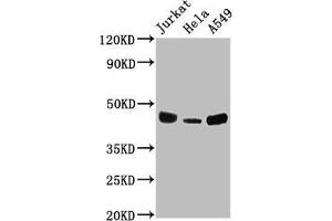 Western Blot Positive WB detected in: Jurkat whole cell lysate, Hela whole cell lysate, A549 whole cell lysate All lanes: HLA-C antibody at 1:2000 Secondary Goat polyclonal to rabbit IgG at 1/50000 dilution Predicted band size: 41 kDa Observed band size: 41 kDa (HLA-C antibody  (AA 25-308))