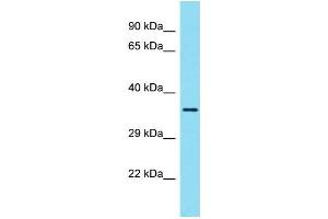 Western Blotting (WB) image for anti-Ubiquitin Thioesterase OTU1 (YOD1) (N-Term) antibody (ABIN2790891) (YOD1 antibody  (N-Term))
