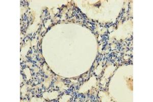 Immunohistochemistry of paraffin-embedded human lung tissue using ABIN7172870 at dilution of 1:100 (TRPM8 antibody  (AA 1-192))