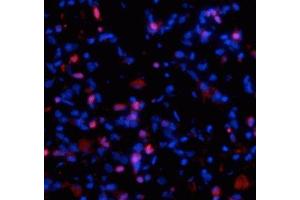 Immunostaining of fibrotic mouse lung tissue showing specific staining of collagen I  molecules (red) that are still associated with the cells in which they were synthesized. (COL1A1 antibody)