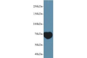 Detection of MIB2 in Mouse Serum using Polyclonal Antibody to Mindbomb Homolog 2 (MIB2) (MIB2 antibody  (AA 546-784))