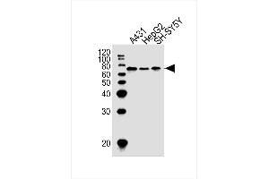 Lane 1: A431 Cell lysates, Lane 2: HepG2 Cell lysates, Lane 3: SH-SY5Y Cell lysates, probed with EIF2AK2 (1441CT628. (EIF2AK2 antibody)
