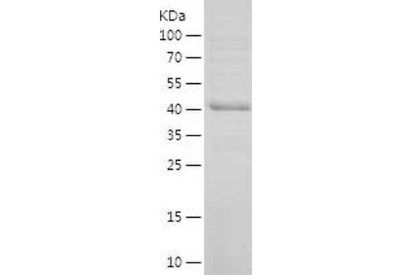 MGMT Protein (AA 1-207) (His-IF2DI Tag)