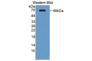 Figure. (DcR1 antibody  (AA 32-244))