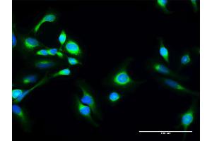 Immunofluorescence of purified MaxPab antibody to SACM1L on HeLa cell. (SACM1L antibody  (AA 1-587))