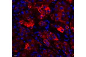 Immunofluorescence of paraffin embedded human liver using RBP (ABIN7075409) at dilution of 1: 650 (400x lens) (RBP4 antibody)