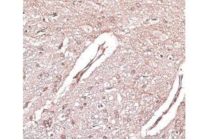 Immunohistochemistry of paraffin-embedded Rat brain using LMO4 Polyclonal Antibody at dilution of 1:100 (40x lens). (LMO4 antibody)