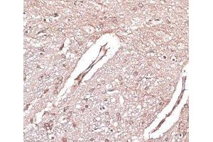 Immunohistochemistry of paraffin-embedded Rat brain using LMO4 Polyclonal Antibody at dilution of 1:100 (40x lens).