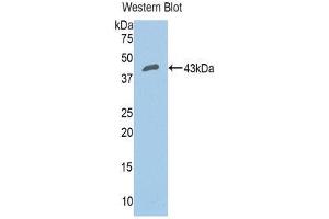 Western Blotting (WB) image for anti-Complement Factor B (CFB) (AA 35-160) antibody (ABIN3205634) (Complement Factor B antibody  (AA 35-160))