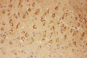 Anti-CNTF Picoband antibody,  IHC(P): Rat Brain Tissue (CNTF antibody  (AA 2-200))