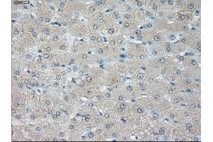 Immunohistochemical staining of paraffin-embedded liver tissue using anti-HSD17B10 mouse monoclonal antibody. (HSD17B10 antibody)